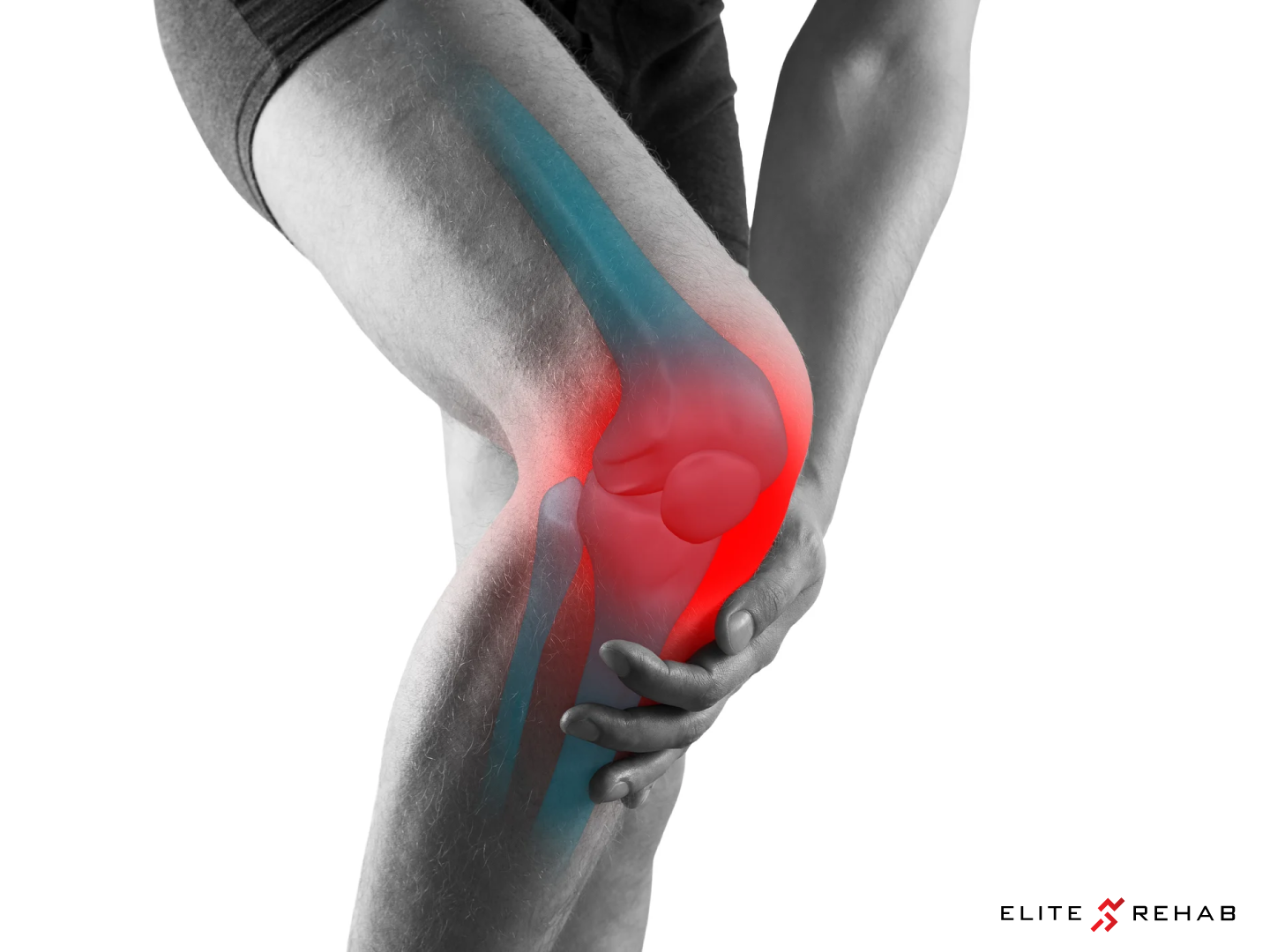 How Long Does It Take to Heal After ACL Reconstruction?: David